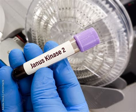 jak2 blood test bottle|what is jak 2 positive.